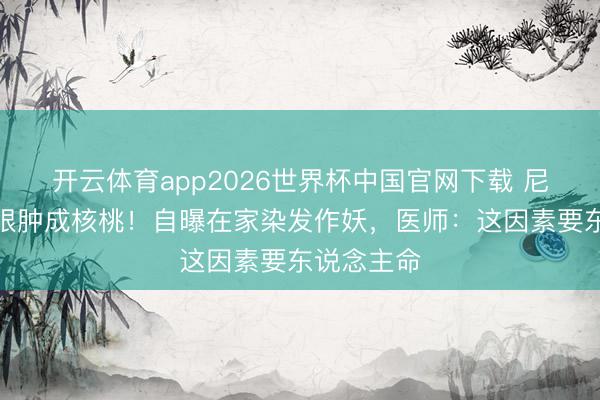 开云体育app2026世界杯中国官网下载 尼格买提右眼肿成核桃!自曝在家染发作妖,医师:这因素要东说念主命
