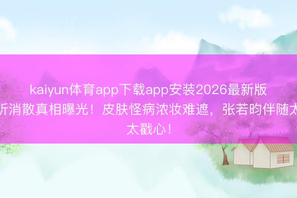 kaiyun体育app下载app安装2026最新版 唐艺昕消散真相曝光！皮肤怪病浓妆难遮，张若昀伴随太戳心！